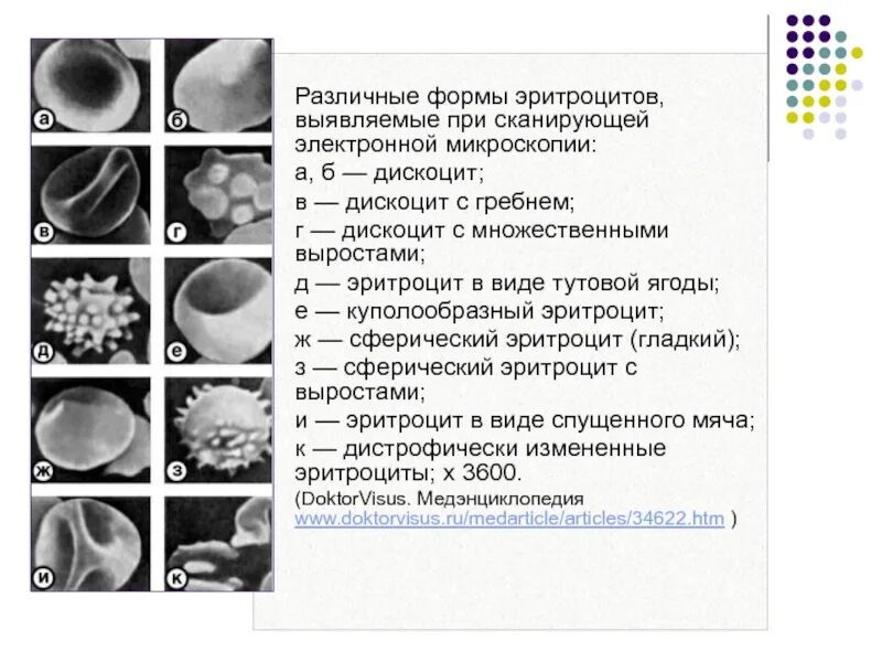 Эритроциты различной формы. Форма эритроцитов. различные по форме эритроцитов. типы эритроцитов. эритроциты различной формы в сканирующем электронном микроскопе.