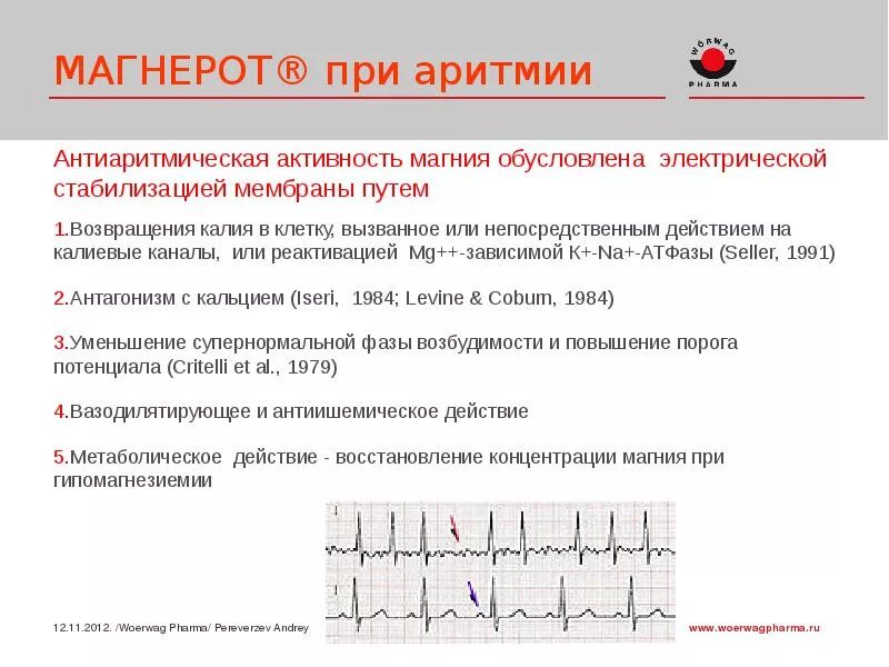 Пароксизмальная тахикардия мерцательная аритмия. Препараты калия и магния при аритмиях. препараты калия для сердца при аритмии. препараты магния при аритмии. препараты калия эффективные при аритмиях.