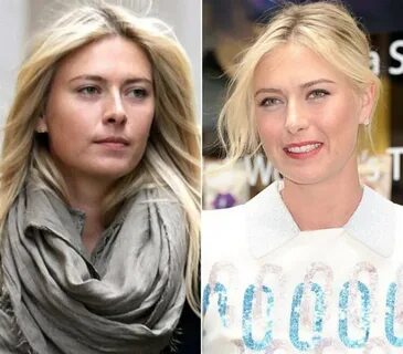 Шарапова после пластики