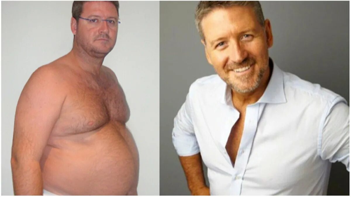 Пациент с болью в спине. Лишний вес у женщин. Женщина с лишком весом. Женщина с лишним весом. Здоровый пациент.