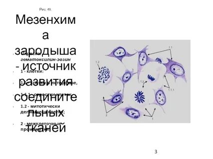 Мезенхима