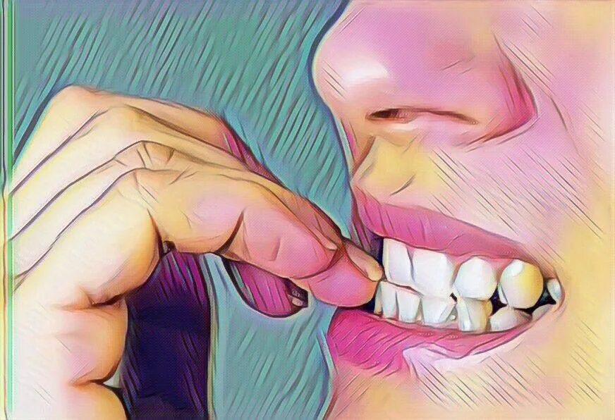 Грызть ногти как называется. Грызть ногти вредная привычка. девушка грызет ногти.
