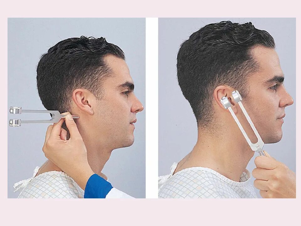 исследование слуховой функции камертонами. исследование камертонами опыт ринне. исследования с помощью камертонов. исследование костной проводимости (камертон с128). методы исследования органа слуха.