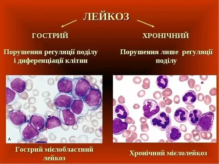 Острая и с ней