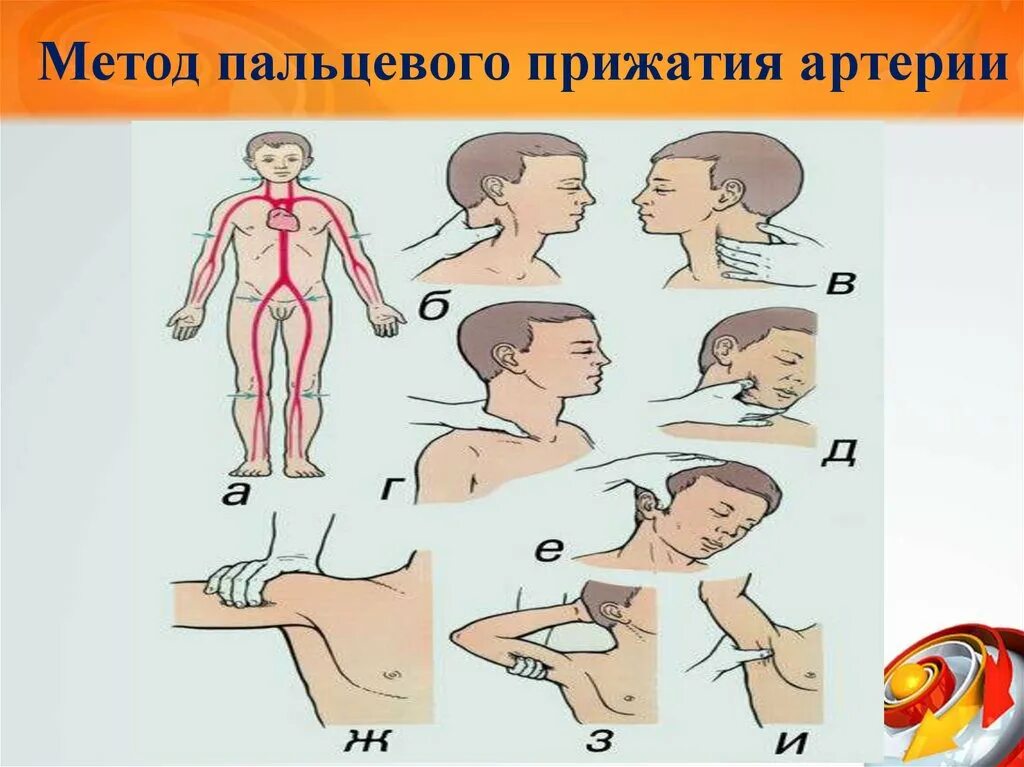 Способы остановки кровотечения пальцевое прижатие артерии. Метод пальцевого прижатия артерий. Пальцевое прижатие методика. Метод пальцевого прижатия сосудов. Алгоритм пальцевого прижатия артерии.