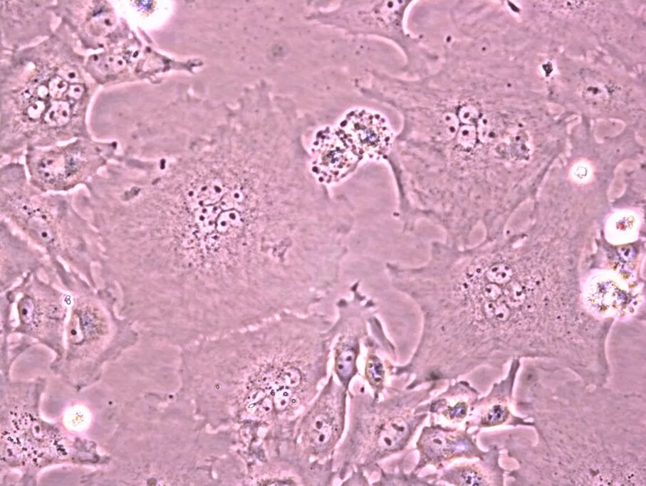 Микоплазмы ureaplasma spp