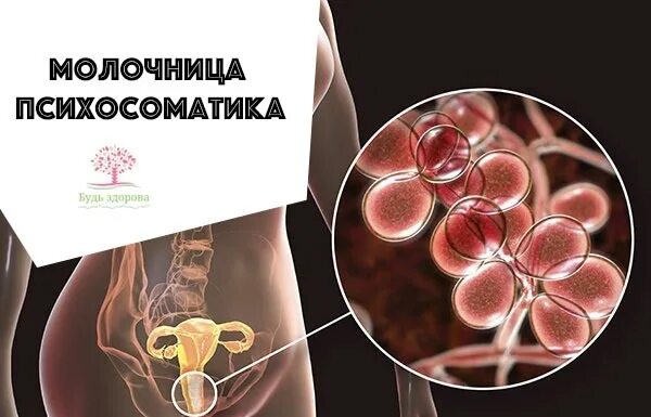 Что вызывает молочницу