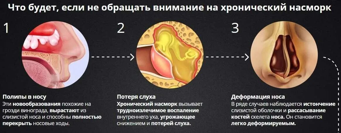Почему после острого