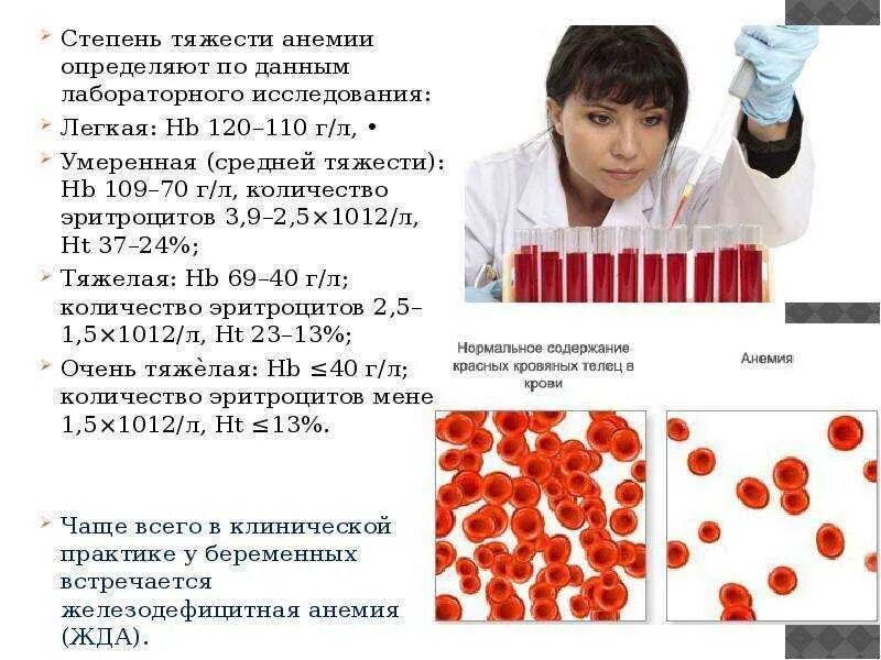 Если гемоглобин низкий какие симптомы бывают. Степени железодефицитной анемии. анемия картинки. стадии низкого гемоглобина. анемия в легкой форме.