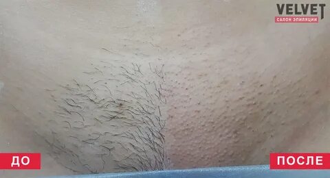Глубокое бикини самой себе