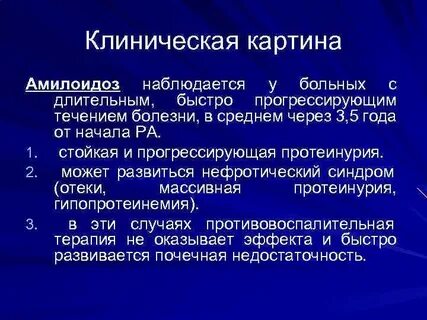 Синдром амилоидоз
