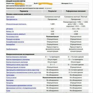 Эритроциты лейкоциты слизь в моче