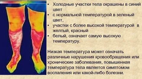 Нарушение кровообращения нижних