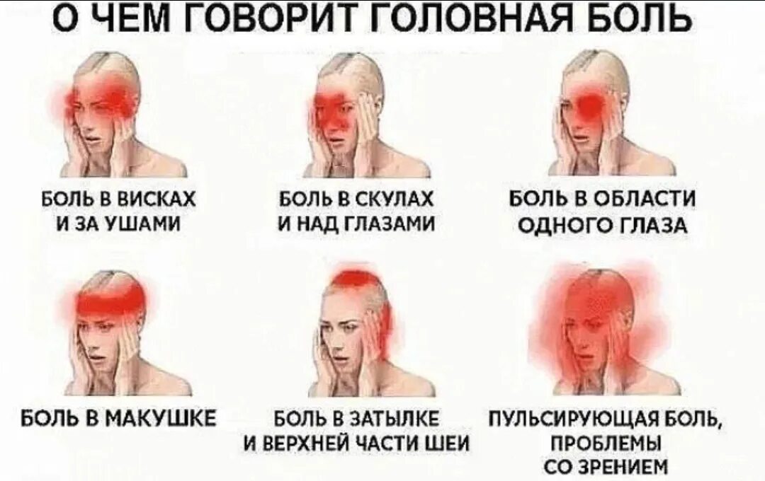 Головная боль после давления. Причины головной боли. головная боль локализация. виды головной. головная боль части головы.