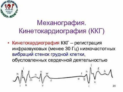 Механография это