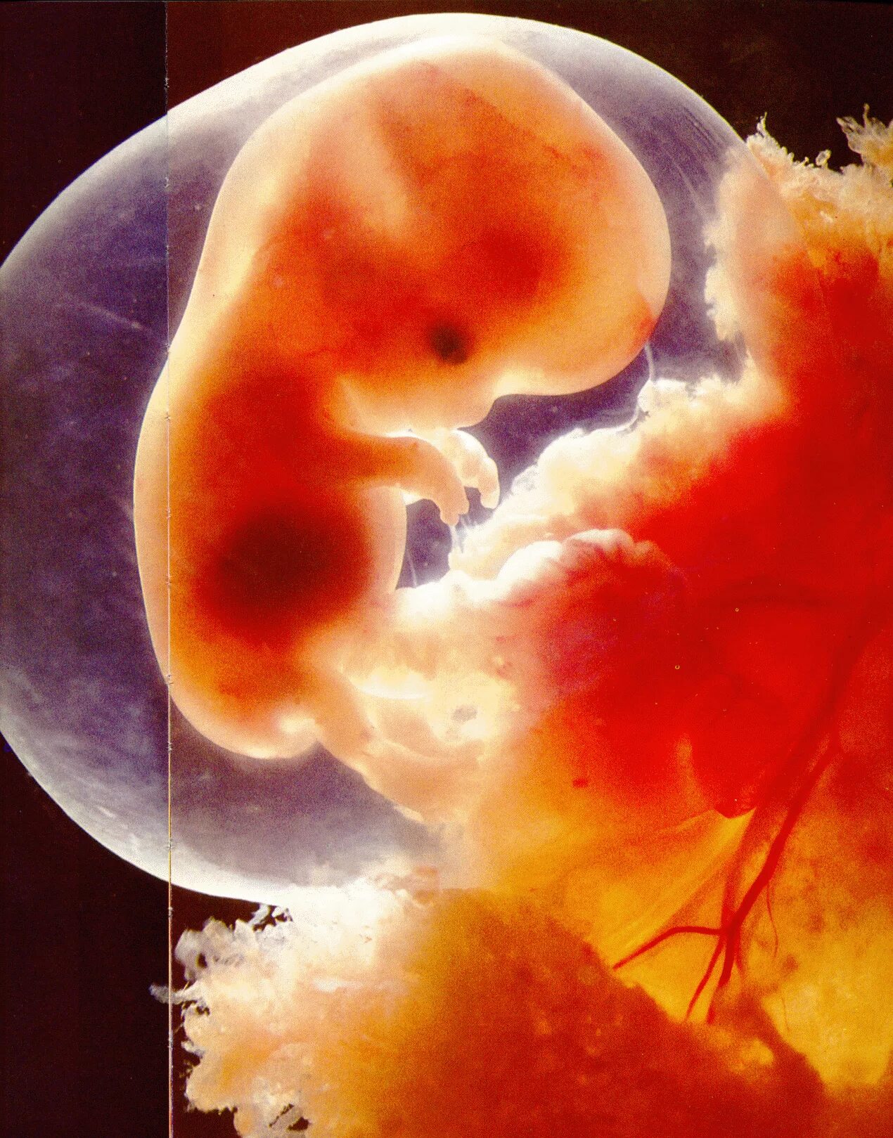 9 неделя развития плода. Эмбрион на 8 неделе беременности. 8 Недель беременности фото эмбриона. Эмбрион на 9 неделе беременности. Человеческий эмбрион на 8 неделе беременности.