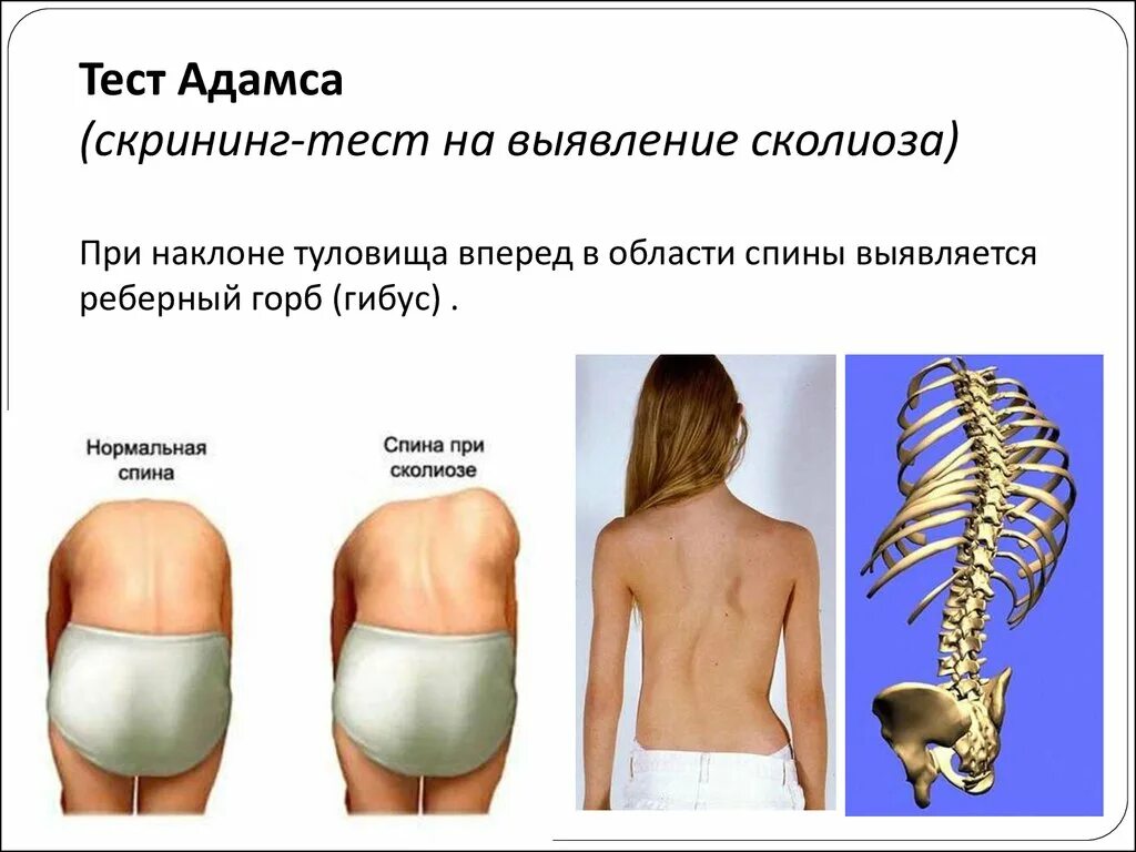 Какой врач проверяет позвоночник