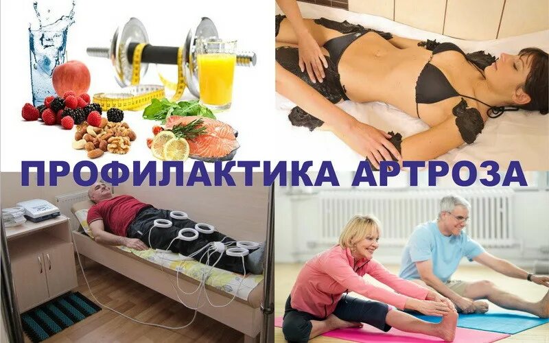 профилактика остеоартроза. деформирующий артроз коленного сустава стадии. профилактика артроза суставов у женщин. профилактика артроза суставов у женщин. памятка остеоартроза.