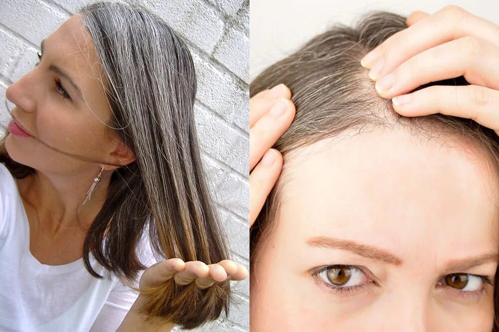 Преждевременное поседение волос. Ранняя Седина волос. Раннее поседение волос у женщин. Появились Седые волосы. Ранняя седина причины