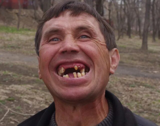 урод смеется