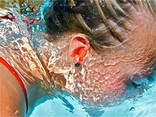 После моря вода в ухе. После моря вода в ухе