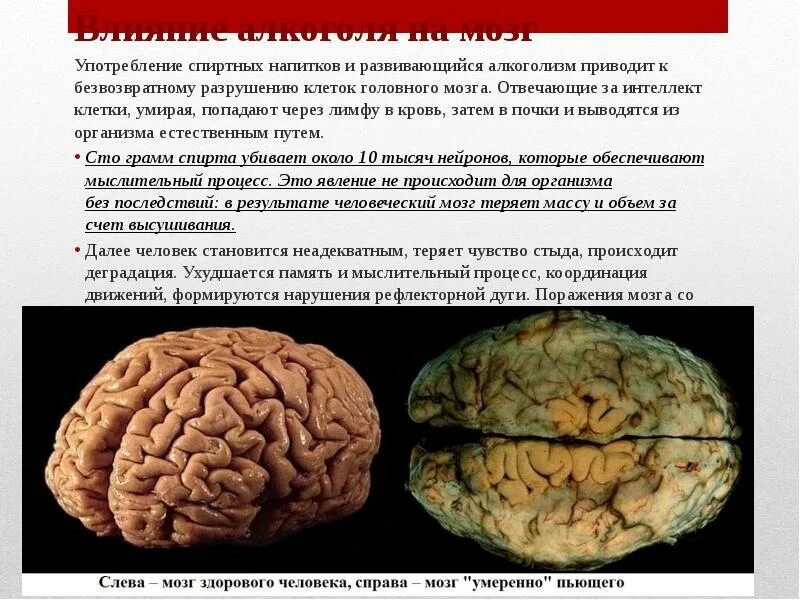 Мозг человека алкоголика. Мозг человека и мозг алкоголика.