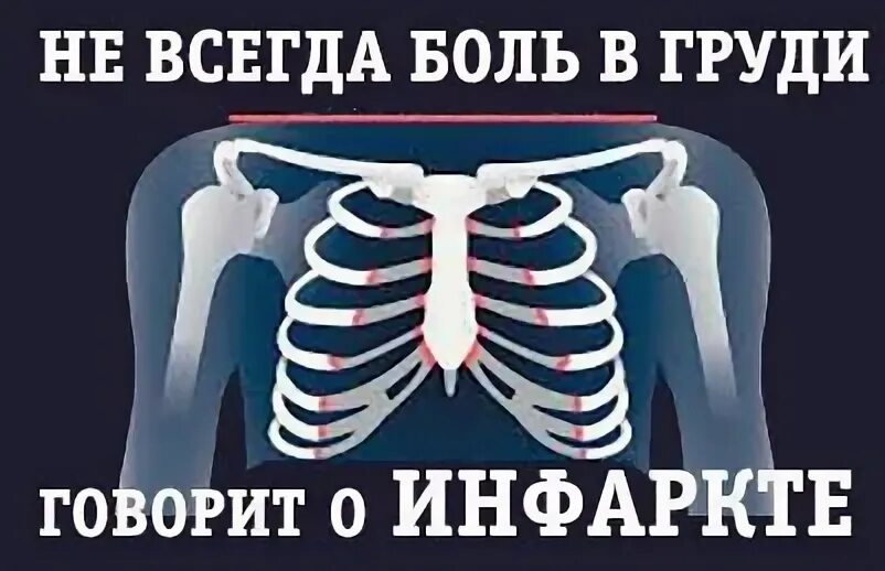 Боль в грудной клетке посередине. Боль в грудной клетке посередине причины. Виды боли в грудной клетке. Человечек с грудной клеткой посередине. Боли под правой грудиной