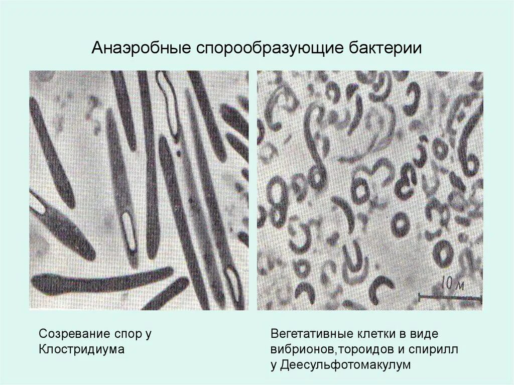 Микроорганизмы образующие споры. Анаэробные микроорганизмы грамположительные палочки. Грамположительные спорообразующие аэробные бактерии. Анаэробные спорообразующие палочковидные бактерии. Бациллы и клостридии.