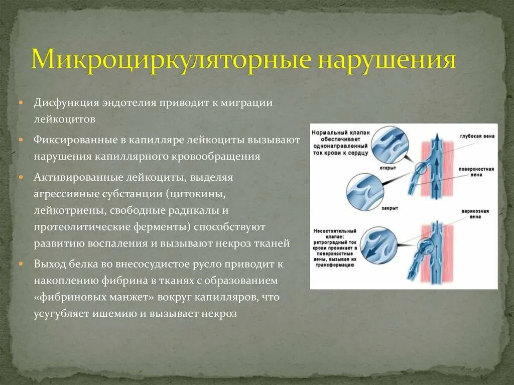 Дисфункция крови. Нарушение микроциркуляции. Микроциркуляторные расстройства. Нарушение микроциркуляторного кровообращения. Дисфункция эндотелия.