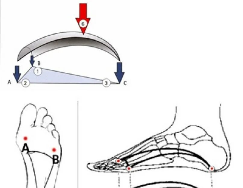 Схема сводов стопы. Своды стопы продольный поперечный схема. Внутренний продольный свод стопы. Пассивные затяжки сводов стопы.