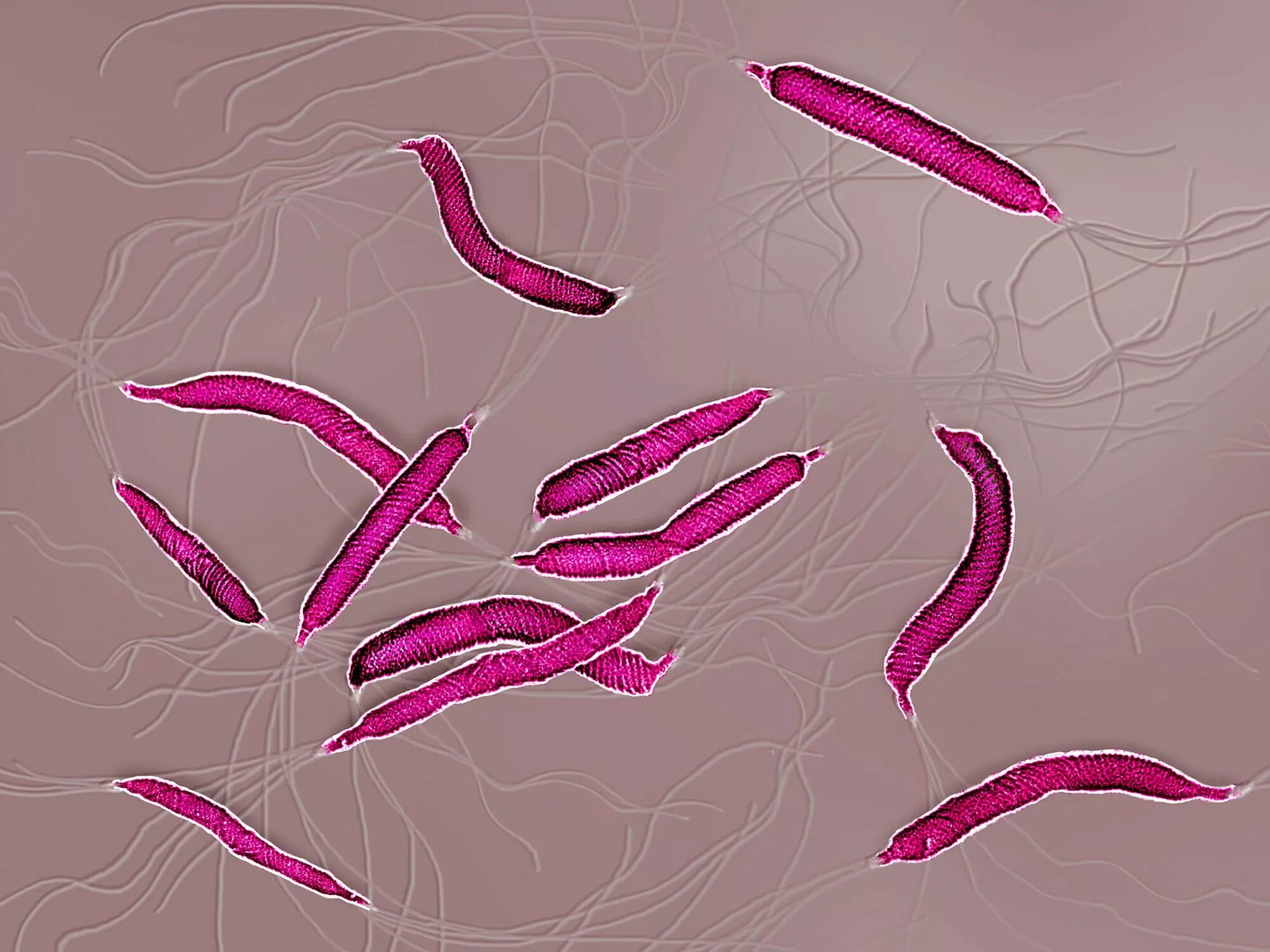 Бактерии хеликобактер пилори микроскопия. Helicobacter pylori микробиология. Хеликобактер пилори микроскопия. Helicobacter pylori микроскопия. Пилори язва