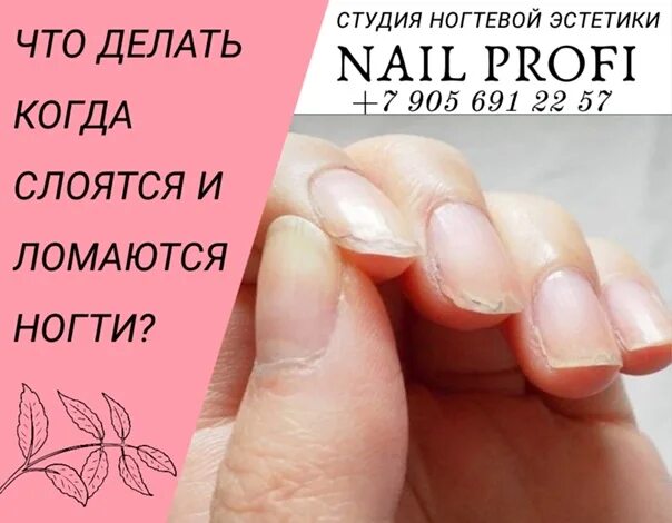 Почему ногти на руках ломаются и слоятся. Если слоятся ногти витамины. ногти слоятьсявитамины. нехватка витаминов на ногтях.