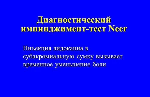 Синдром сдавления ротатора плеча. Нпвс при импинджмент синдроме. противовоспалительная терапия при импиджмент синдроме. импиджмент синдром клинические рекомендации.