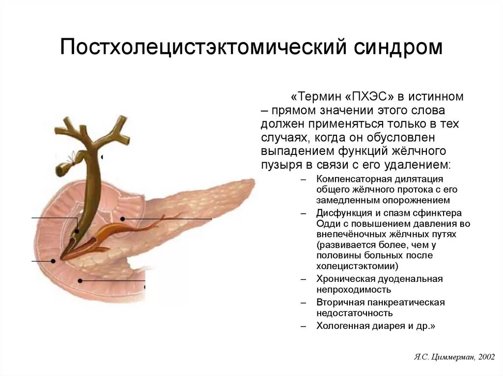 Тошнит после удаления желчного. Постхолецистический синдром клинические рекомендации. Постхолецистэктомический синдром симптомы. Постхолецистэктомический синдром классификация. Патогенез постхолецистэктомического синдрома.