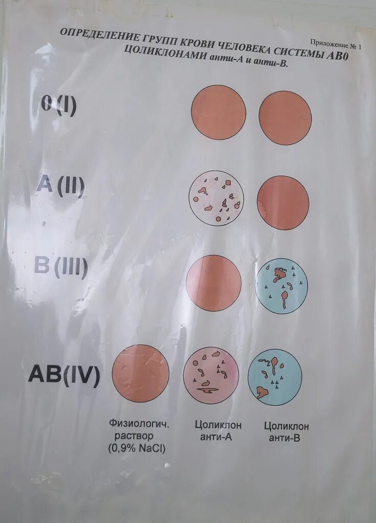 2 Группа крови Цоликлоны. Цоликлоны для определения группы крови и резус. Палетка для определения группы крови. Определить группу крови цоликлонами. Цоликлоны группа крови резус фактор