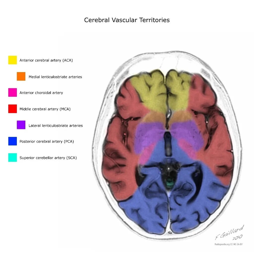 Сма мозга. Зоны кровоснабжения мозговых артерий кт. Бассейны кровоснабжения головного мозга. Бассейн передней мозговой артерии. Бассейн СМА головного мозга схема.