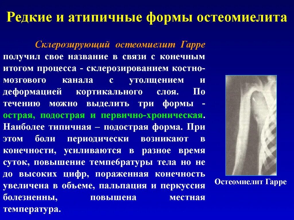 Атипичный остеомиелит. Первично хронические формы остеомиелита. Первично хронический остеомиелит презентация. Атипичный остеомиелит. Атипичный остеомиелит.