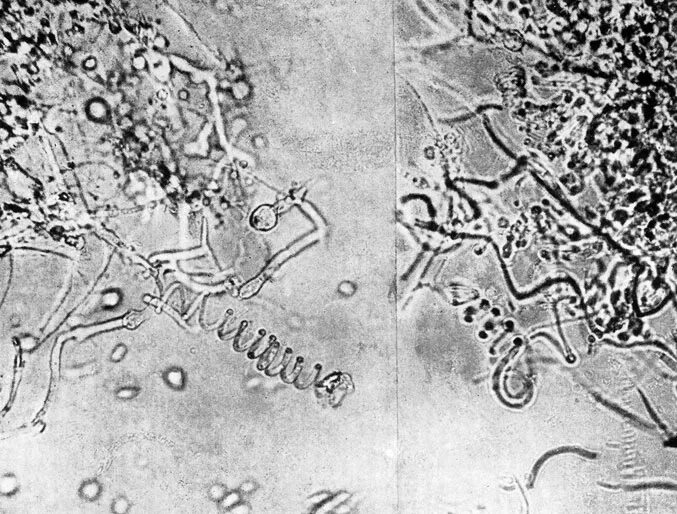 грибы рода микроспорум. трихофития возбудитель. стригущий лишай возбудитель. возбудитель стригущего. возбудитель кератомикоза.