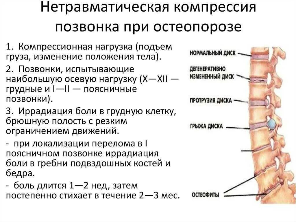 Дорсалгия карта вызова. Компрессионный перелом позвоночника th12 l3. Компрессионный перелом позвоночника th-5-6. Компрессионных переломов тел th12, l1 позвонков. Позвонок l1 компрессионный.