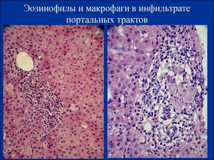 Макрофаги печени