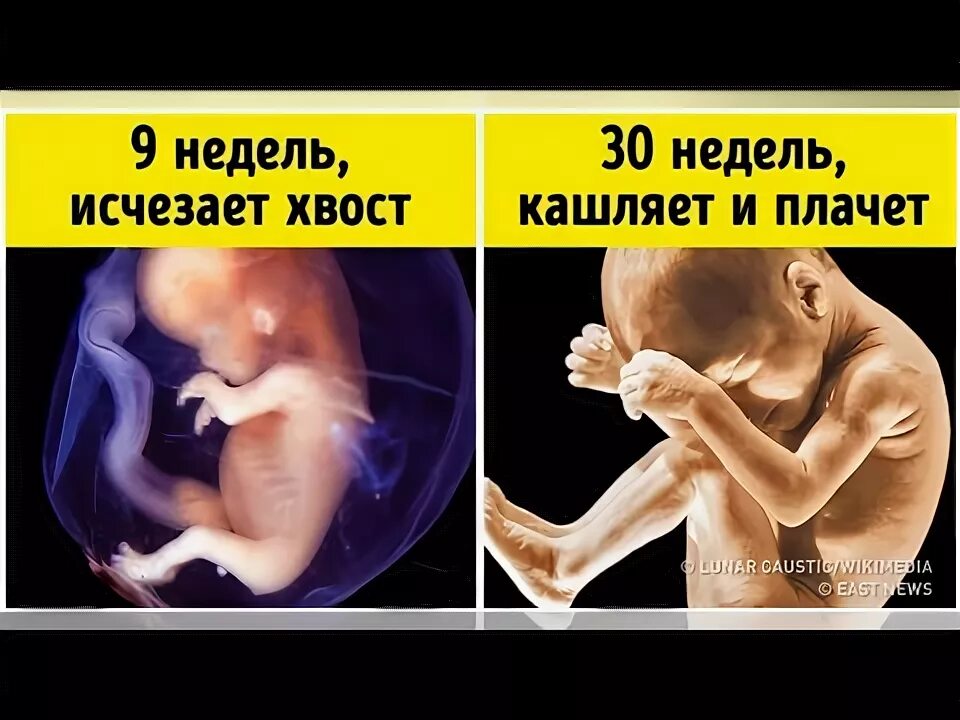 Почему в утробе матери икает. Причины икания малыша в утробе. Дети икают в утробе матери. Ребенок в утробе курящей матери.
