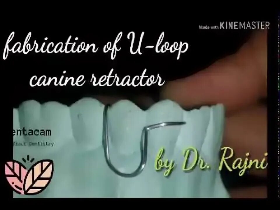 U loop. U loop