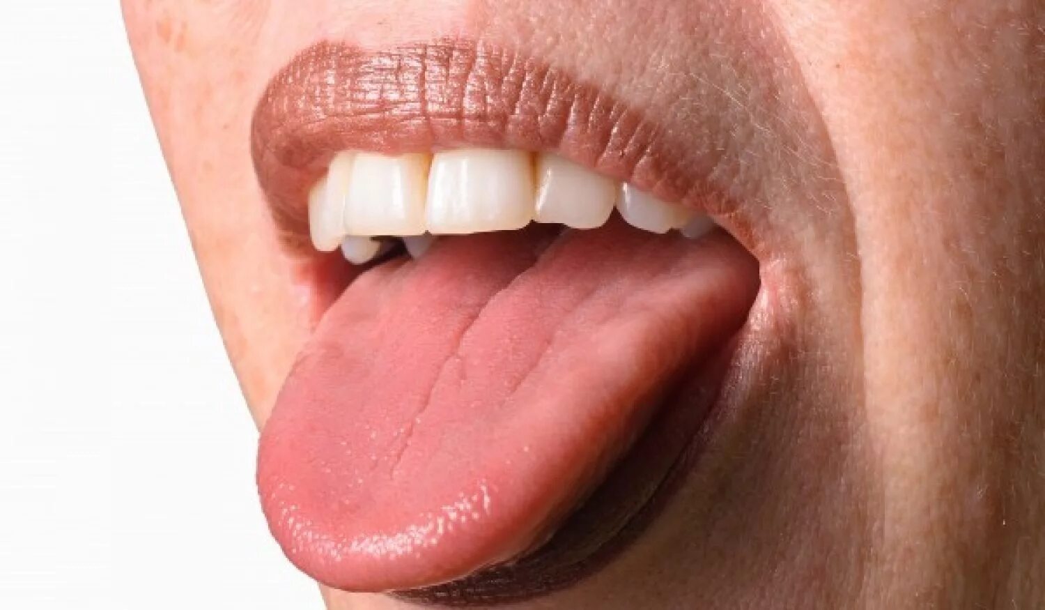 Дискламативный власит. Горечь во рту. Почему жжет во рту. Кандидозный глоссит языка. Глоссит классификация.