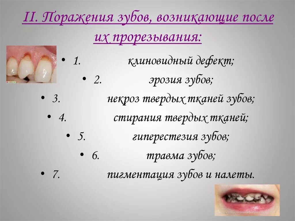 Классификация поражений зубов