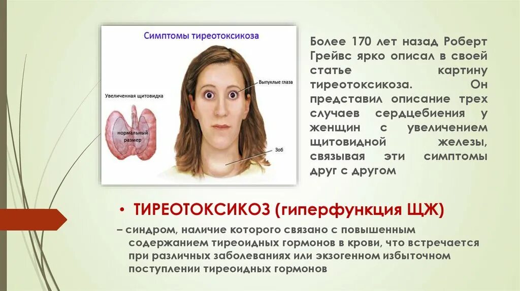 Тиреотоксикоз щитовидной железы. Гипертиреоз щитовидной железы. Щитовидная железа психосоматика. Зоб щитовидной железы психосоматика.