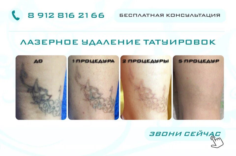 Изображение не требует описания