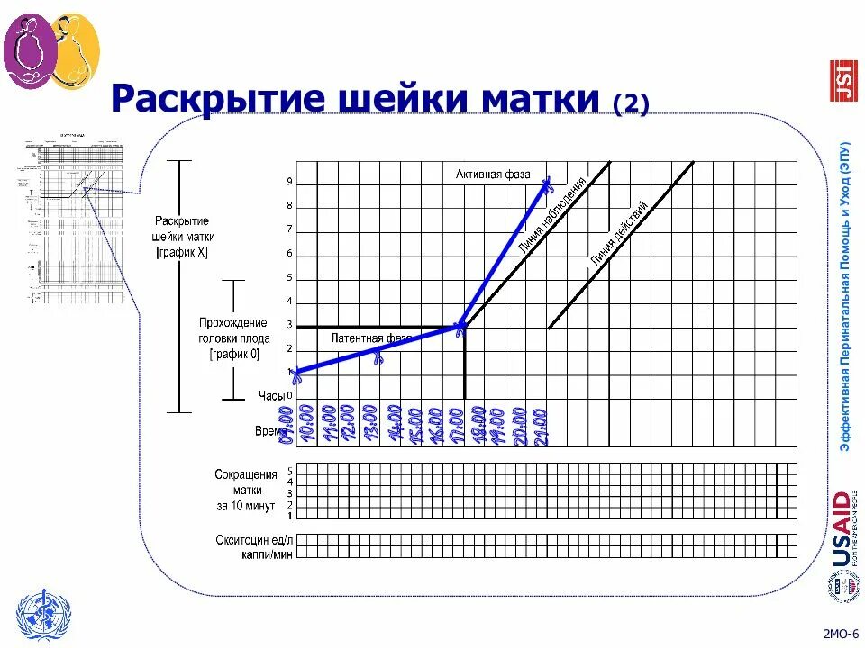 Шейка матки на ощупь. Партограмма раскрытия шейки матки. дискоординация родовой партограмма. партограмма при дискоординации родовой деятельности;.