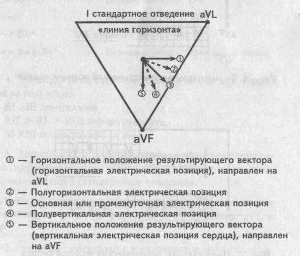 Экг оси вертикальная и горизонтальная. Вертикальное положение эос на экг. Комплекс qrs в v1. Полугоризонтальная эос. Электрическая ось сердца как определить.