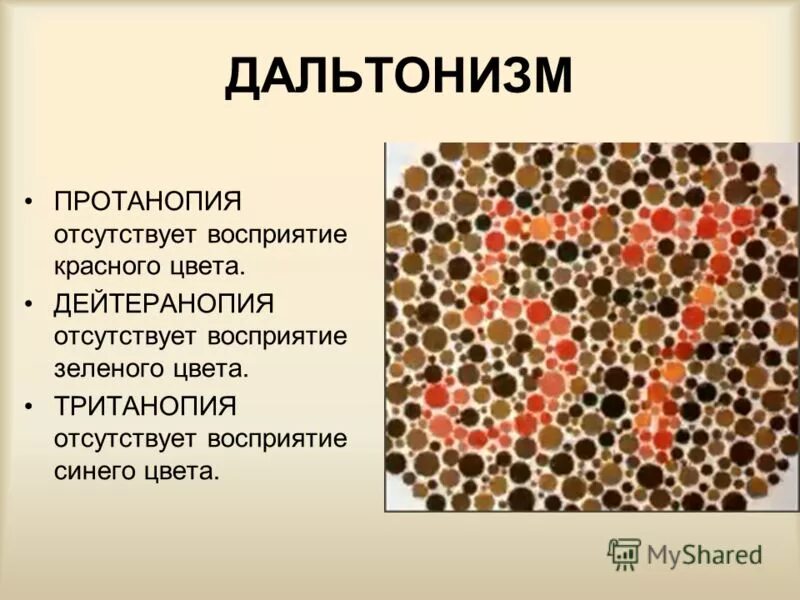 Дальтонизм лечится. Дальтонизм дейтеранопия. дальтонизм протанопия. дихромат дальтонизм. аномалии цветового зрения.