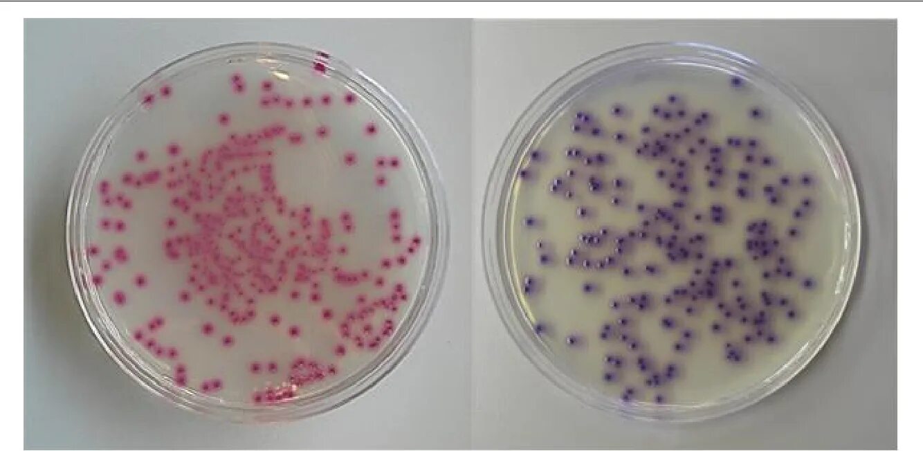 Coli sotwe. Золотистый стафилококк на ЖСА. ЖСА среда микробиология. Хромокульт колиформ агар. Посев стафилококка на ЖСА.